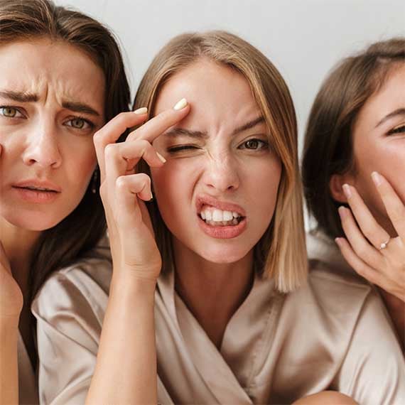 Bye bye pimples