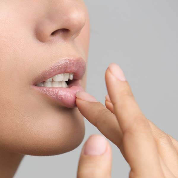 Lip care for dry, chapped lips